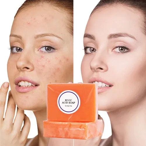 Kojic Acid Original Soap Skin Whitening Brightening and Moisturizing Soap